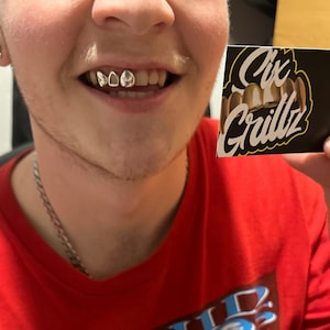 Window Sterling Silver 925 Grillz Any Teeth FREE UK Shipping!!