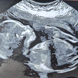 3D Printed Ultrasound Pictures