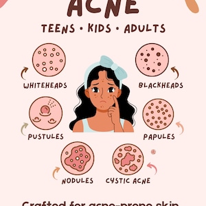 Acne Balm For Pimples • Teen & Adult Post Acne Care • Sensitive Skin • Herbal Salve • Pimple Popper Bild 3