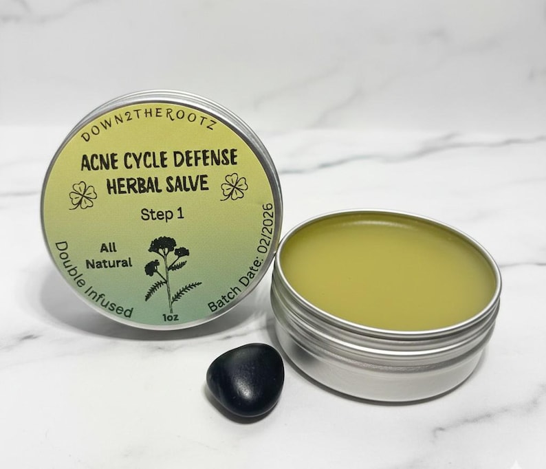 May include: Two open silver tins of herbal salve with a black stone on a marble surface. One tin is labeled "ACNE CYCLE DEFENSE HERBAL SALVE" with "Step 1" and "All Natural" text. The salve is a light green color. The batch date is 02/2026.