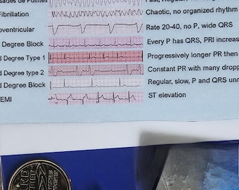 EKG für Pflegekräfte: EKG-Spickzettel (Digitaler Download)