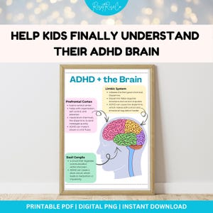 Poster „ADHS: Das Gehirn erklärt“ | Infografik zu exekutiven Funktionen zum Ausdrucken | ADHS-Visualisierung für Kinder, Eltern und Lehrkräfte