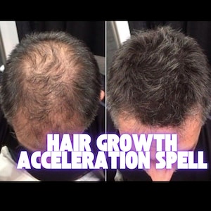 Hair Growth Acceleration Spell – Fast Hair Regrowth Ritual for Thick, Healthy Hair