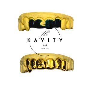 Custom Gap Grillz: 925 Sterling Silver, Free Mold Kit