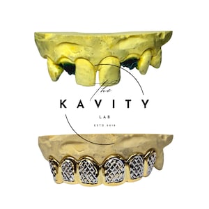 Custom Diamond Cut Grillz for Missing Tooth: 925 Sterling Silver (Free Mold Kit)