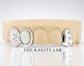 Custom 3pcs Opal Stone, Moissanite & Hammered Grillz: 925 Sterling Silver (Free Mold Kit)