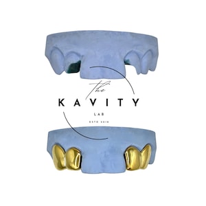 Custom Sterling Silver Gap Grillz: Free Mold Kit & Shipping