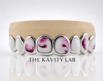 Custom 8pcs Red and White Marble Enamel Grillz: 925 Sterling Silver (Free Mold Kit)
