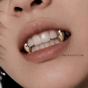 May include: A set of gold tooth caps shaped like fangs fitted over the upper canine teeth. The metallic gold covers are smooth and reflective, positioned on the teeth within a mouth. The text THE KAVITY LAB is printed in black on the lower right.