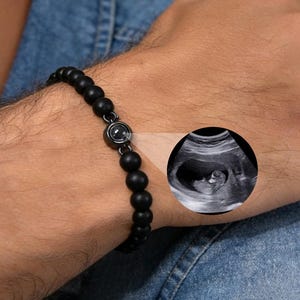 Op de afbeelding: Zwart kralenarmband met een cirkelvormige bedel. Een kleine grijswaarden echografieafbeelding wordt naast de armband weergegeven. De armband wordt om de pols gedragen, tegen een spijkeroverhemd.
