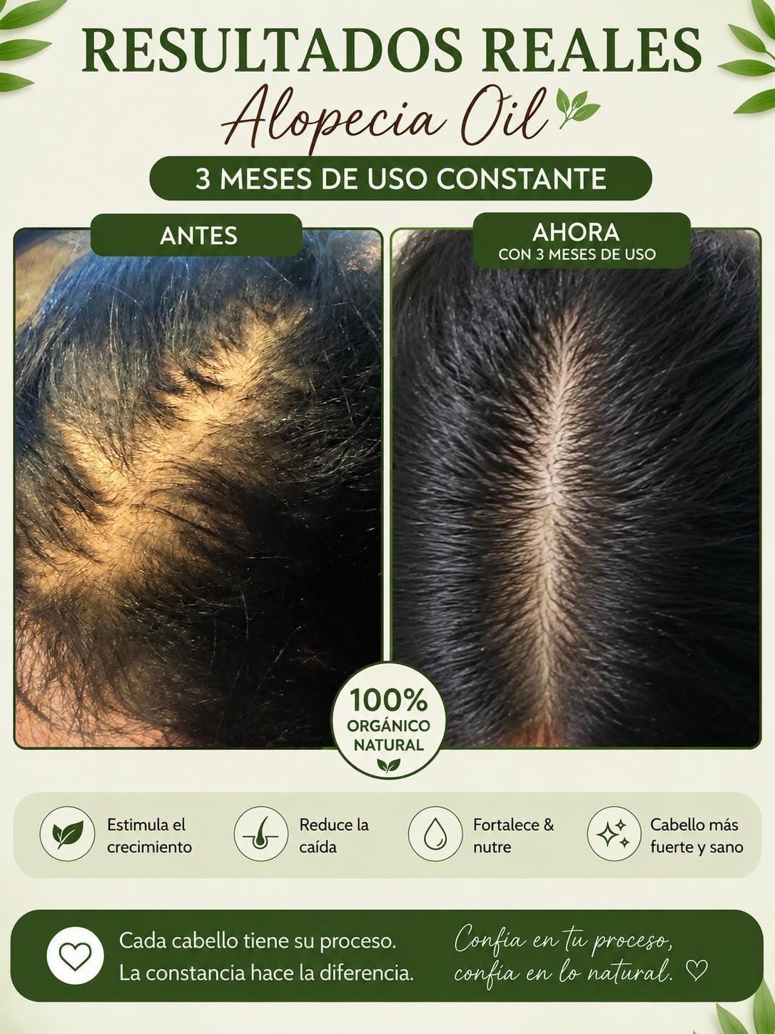 alopecia treatment oil