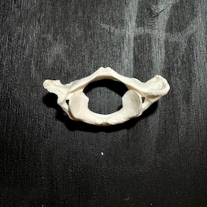 May include: A single off-white cervical vertebra bone featuring a central vertebral foramen, two lateral masses with superior articular facets, and a posterior arch. The bone has a porous, textured surface and is shown from a superior view.