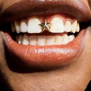 Two-Tone Star Tooth Cap: Silver & Gold Orthodontic Charm