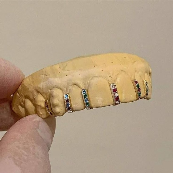 Two-Tone Gold & Silver Tooth Cap: Diamond-Encrusted Grillz Jewelry