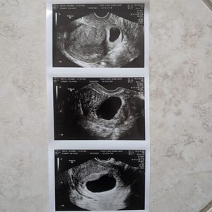 May include: A series of three black and white ultrasound images, each showing a developing fetus. The images are printed on a white strip of paper, with text at the top of each image. The images are on a tiled surface.
