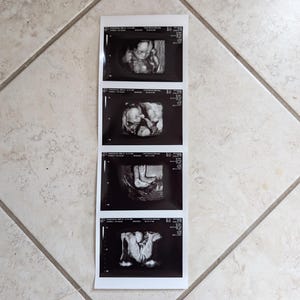 May include: A strip of four black and white ultrasound images, showing developing fetus. The images are rectangular and arranged vertically on a white background. The images are on a tiled floor.