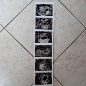 May include: A strip of five black and white ultrasound images. Each image shows a cross-section of a developing fetus. The images are arranged vertically on a light-colored tile surface.