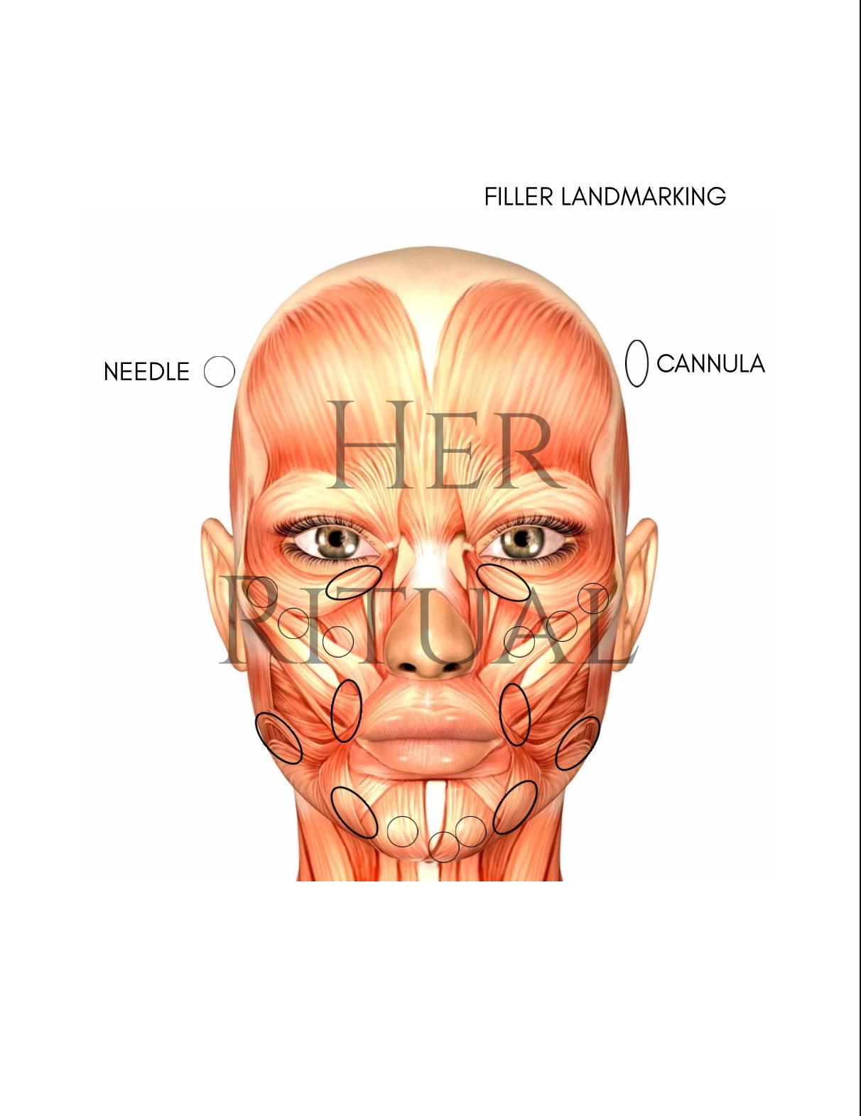 NURSE INJECTOR Anatomy Facemap | Botox Dosing and Landmarking ...
