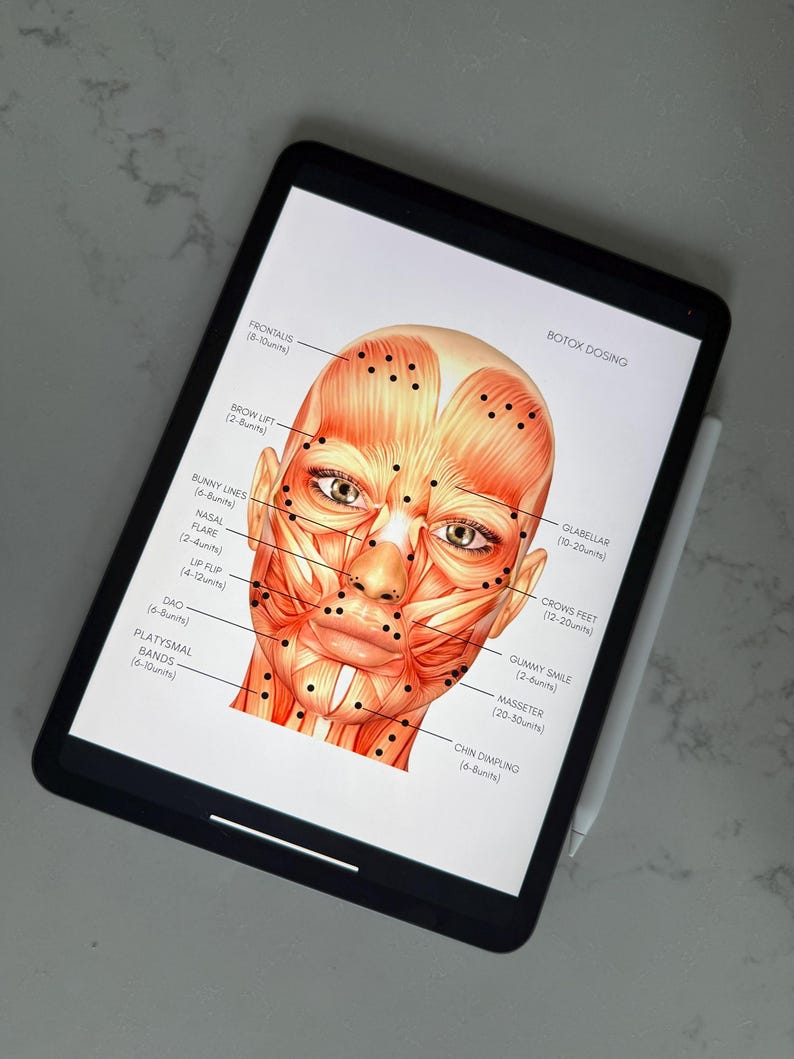 NURSE INJECTOR Anatomy Facemap | Botox Dosing and Landmarking ...