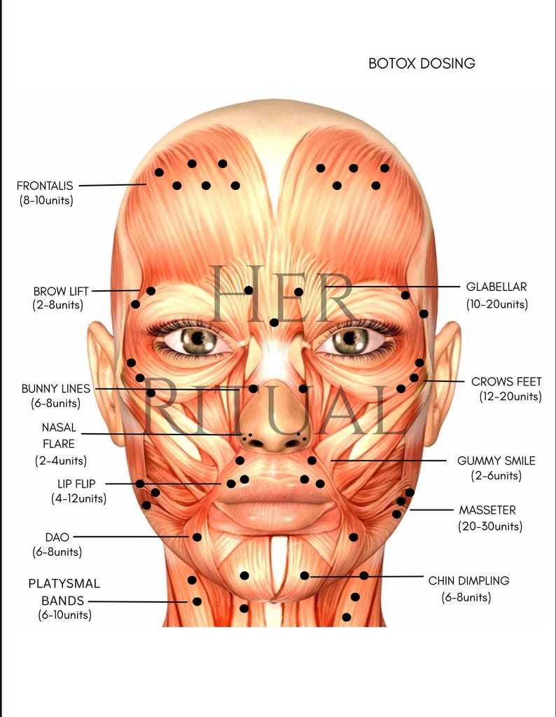 NURSE INJECTOR Anatomy Facemap | Botox Dosing and Landmarking ...
