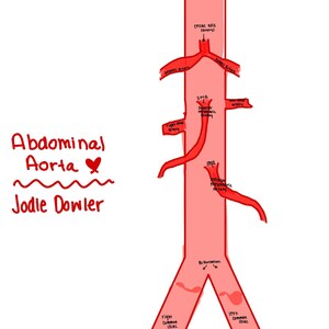 May include: A hand-drawn illustration of the abdominal aorta, depicted in red, with labeled arteries and anatomical features. The text "Abdominal Aorta" and "Jodie Dowler" are also included.