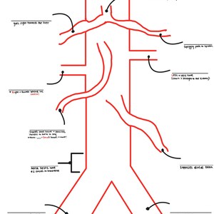 May include: A diagram of the human aorta and its branches, drawn in red on a white background. The diagram includes labels such as "Aka, the 'seagull' sign!" and "Supplies distal colon." The aorta splits into two legs.