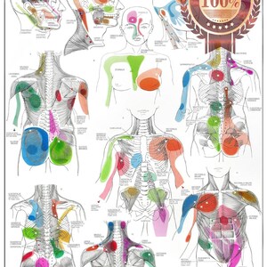 Understanding Pain Trigger Points And Nerve Locations In The Human Body Detailed Anatomical Sketch Illustrates Image387463745 - Foto 2