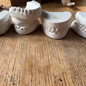 May include: Several white plaster dental molds are arranged on a wooden surface. The molds depict upper and lower teeth, showcasing the shape and arrangement of the teeth. The molds are likely used for dental study or practice.