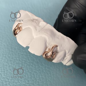 Golden fire Teeth Grillz Set | Custom Fire Grillz | 10k 14k 18k Gold Grillz | White & Rose Gold | Silver Grillz | Gold Teeth Custom Jewelry