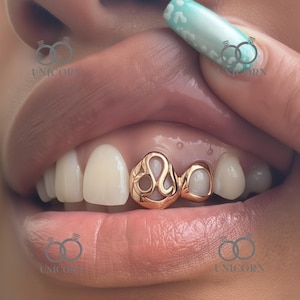 Golden fire Teeth Grillz Set | Custom Fire Grillz | 10k 14k 18k Gold Grillz | White & Rose Gold | Silver Grillz | Gold Teeth Jewelry