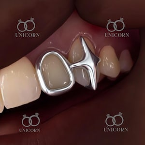 Può includere: Primo piano di un lavoro dentale con una capsula dentale argentata e un attacco dentale a forma di stella. La capsula è liscia e lucida, con una superficie color dente naturale. Il pezzo a forma di stella aggiunge un elemento di design unico. La parola "UNICORN" è visibile.