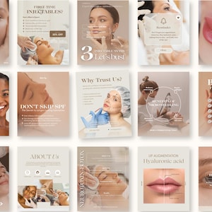 May include: A collection of promotional posters for cosmetic procedures. The posters feature images of people undergoing treatments, along with text about injectables, Botox, and lip augmentation. The color palette is neutral with beige and brown tones.