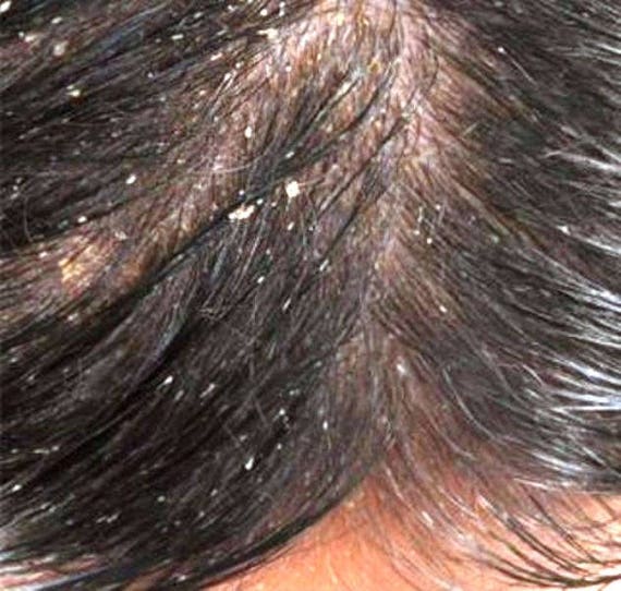 Jamaican Black Castor Oil Hair Food Thinning Hair Treatment To Etsy