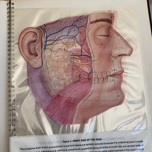 May include: A detailed anatomical illustration of the right side of the human head, showing the muscles, nerves, and blood vessels. The illustration is labeled with numbers and includes the following text: "Figure 1 - Right Side of the Head".
