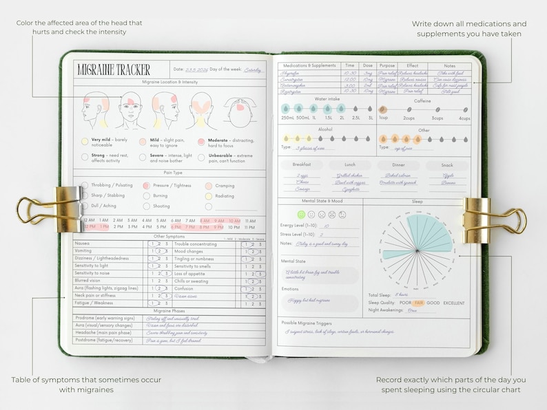 Registro de migraña (PDF imprimible): registro de dolor de cabeza, diario de síntomas, diario de migraña, seguimiento de salud, seguimiento de desencadenantes del aura imagen 2
