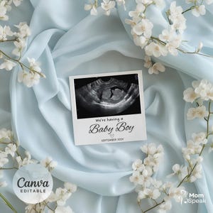 Baby Boy Announcement Template: Editable Ultrasound Reveal, Social Media