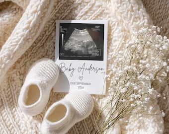 Faire-part de grossesse minimaliste | Révélation neutre de bébé, photo échographique (modèle numérique)