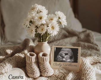Minimalist Pregnancy Announcement | Editable Canva Template with Ultrasound | Simple Digital Download for Baby Reveal