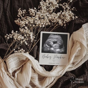 May include: A baby scan image on a white card, with the text "Baby Parker" and "February 202X". The card is surrounded by white flowers and draped fabric in shades of brown and cream.