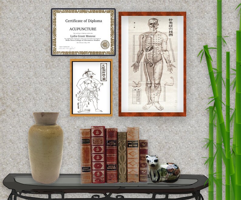 16x20 Medical Reference Poster Ancient & Modern Acupuncture - Etsy