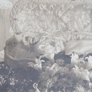 Extremely Rare Antique Post Mortem Photograph of a child with Progeria - Funerary Lilies