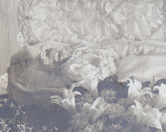 Extremely Rare Antique Post Mortem Photograph of a child with Progeria - Funerary Lilies
