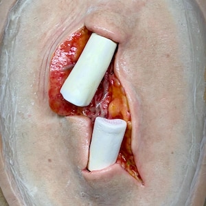 May include: A close-up of a prosthetic wound with two white cylindrical objects inserted into the opening. The wound is surrounded by flesh-toned material with red and yellow details.