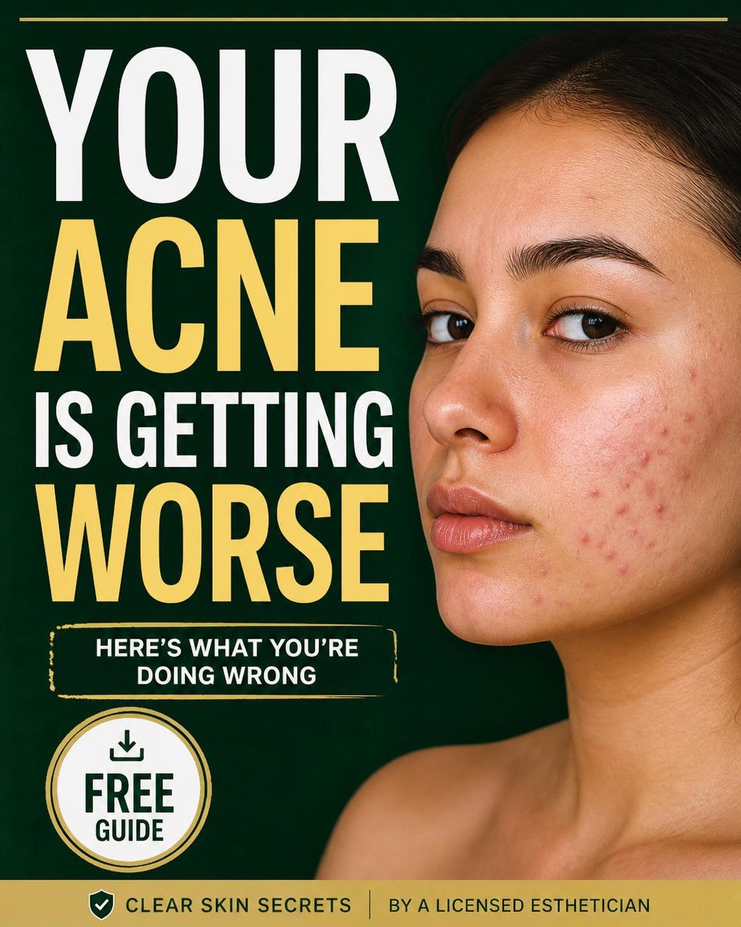 Acne Routine That Actually Works | Fix Your Acne Fast | Skincare Guide ...