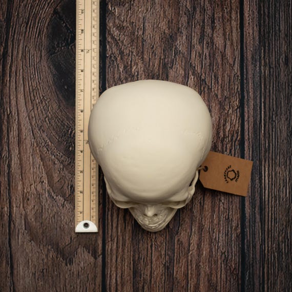 Toddler Skull Anatomy Model: Cut-away Replica With Developing