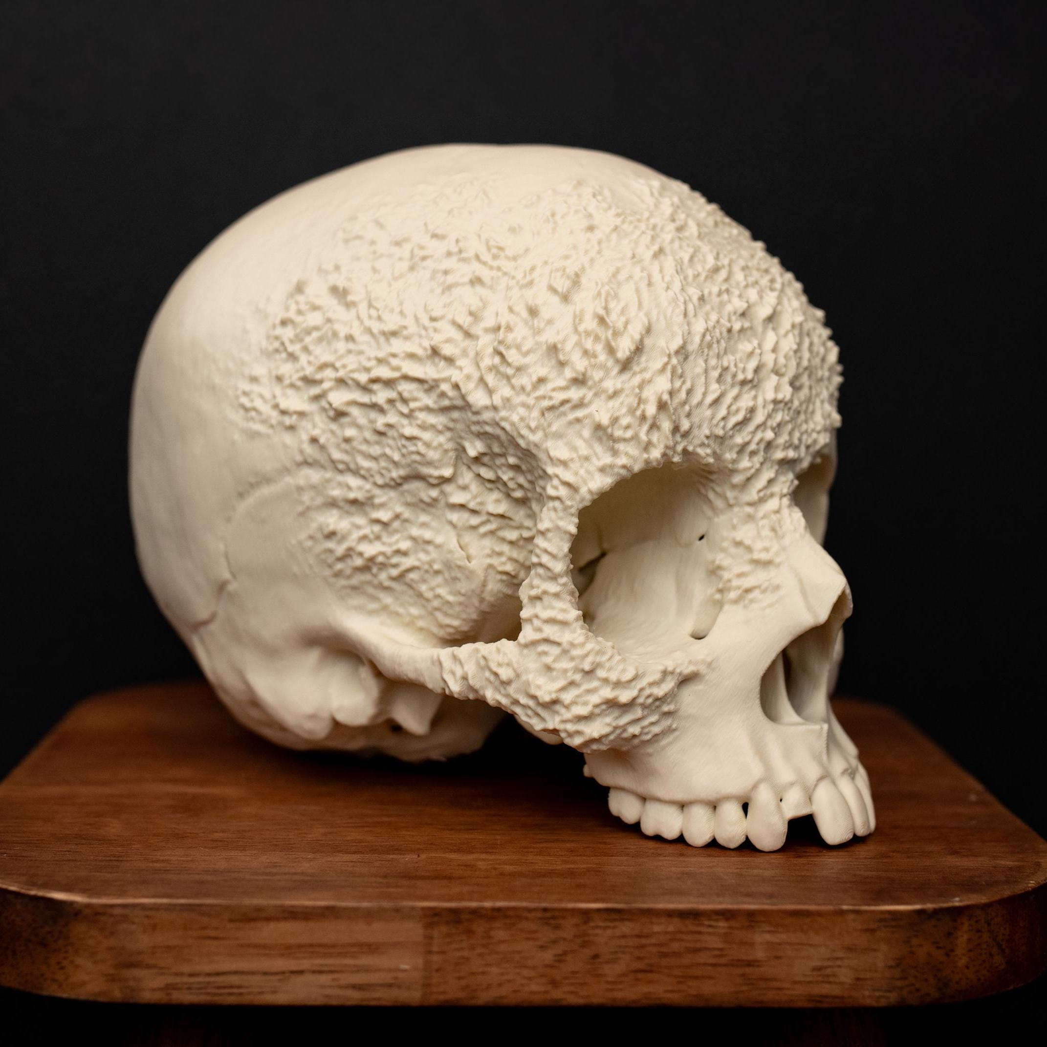 VALIEM MM SKULL (BONE) Mサイズ il_fullxfull.7509793948_eun1.jpg