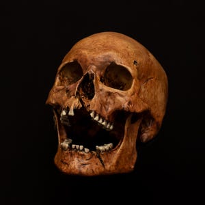 Human Skull Warrior Replica Life sized | Hand Painted | Medieval Warrior Axe Injury