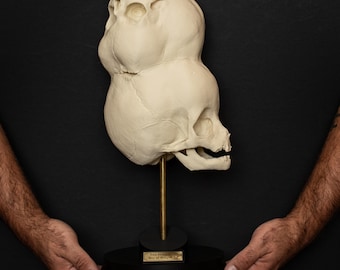 Two-Headed Boy of Bengal Skull Replica: Gothic Medical Oddity Display