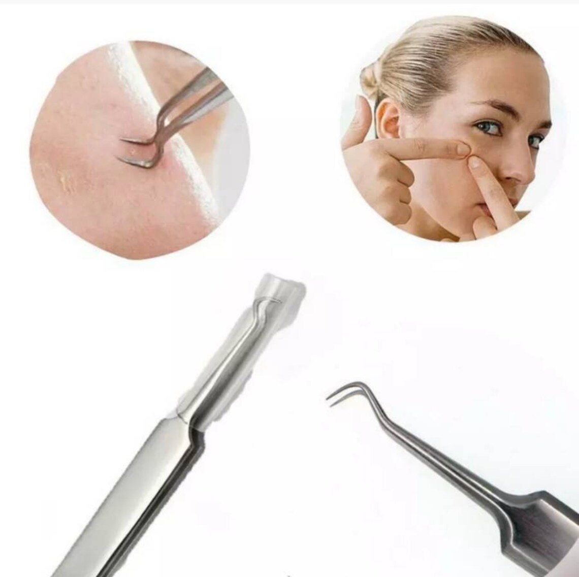Mr. Pimple Popper Pimple Extraction Kit Zit Kit Acne Etsy