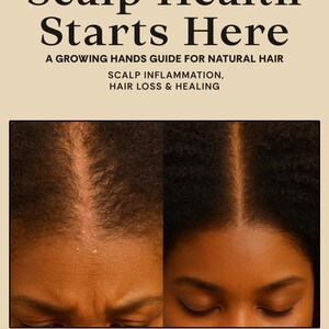 Op de afbeelding: Boekomslag met de titel "Scalp Health Starts Here" en de ondertitel "A Growing Hands Guide for Natural Hair". De omslag bevat afbeeldingen van de hoofdhuid van een persoon en de naam van de auteur is Constance Hunter.
